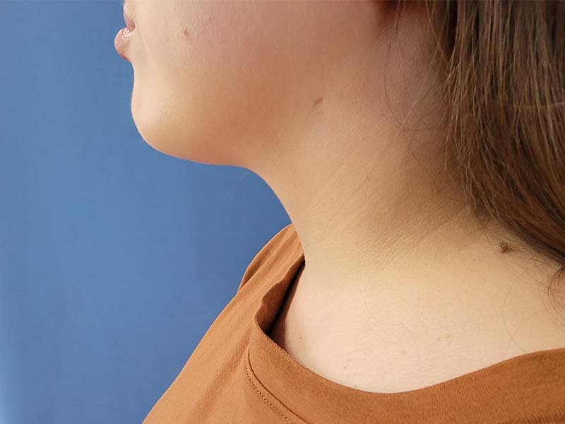 Side profile of a person’s neck and jawline against a blue background