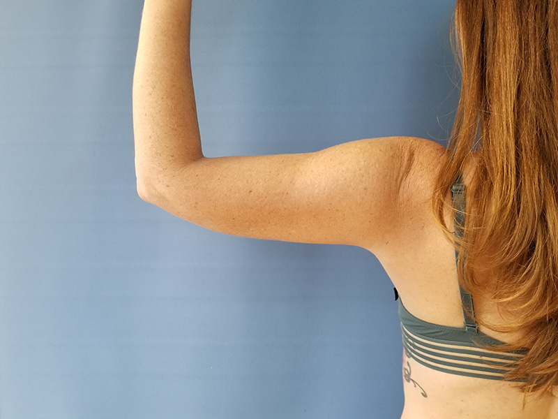 A person with long hair raises their arm against a blue background