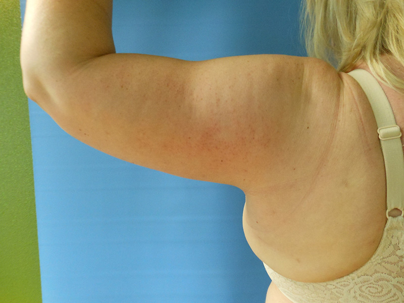 Close-up of a person's bare arm against a blue background