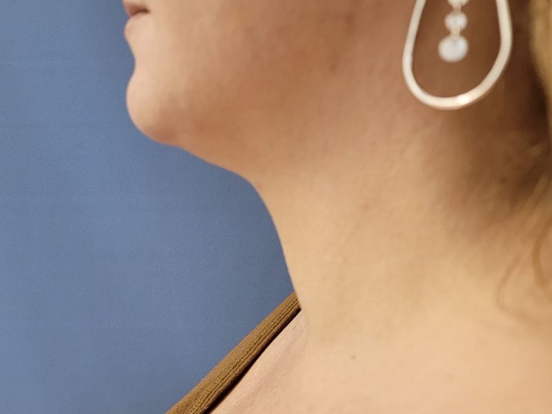 Profile view of a woman's neck and earring against a blue background