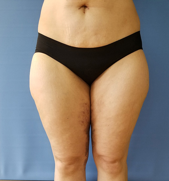 Front view of a person wearing black underwear against a blue background