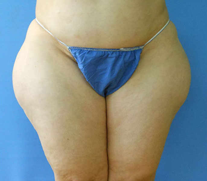Person's lower body wearing a blue thong against a plain blue background