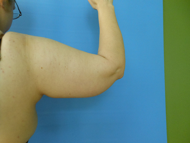 A partially visible arm against a blue background with a green area to the right