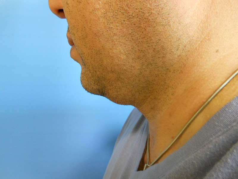 Profile view of a man with short facial hair, wearing a gray shirt, against a blue background