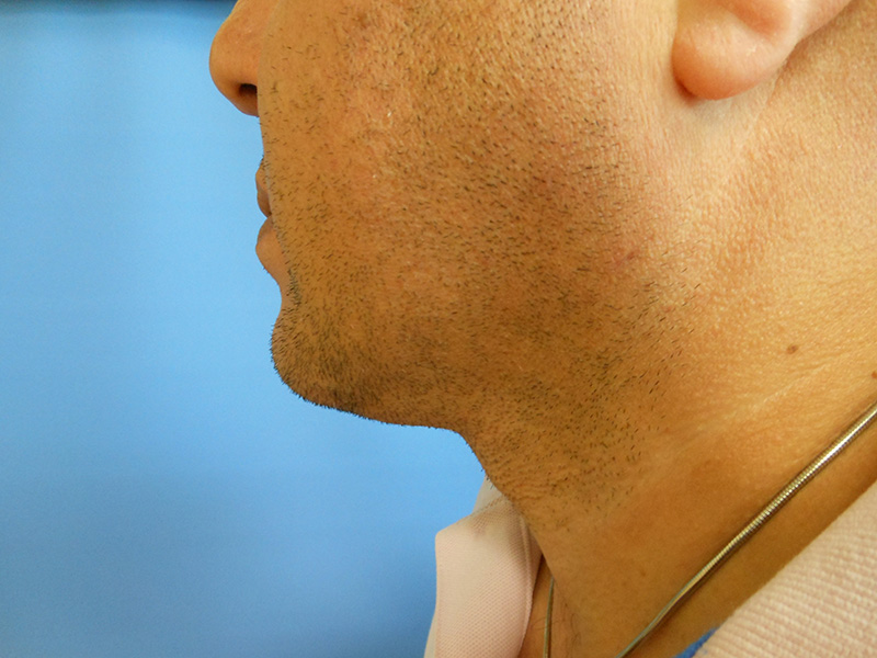 Profile view of a man's face with short hair and light stubble against a blue background