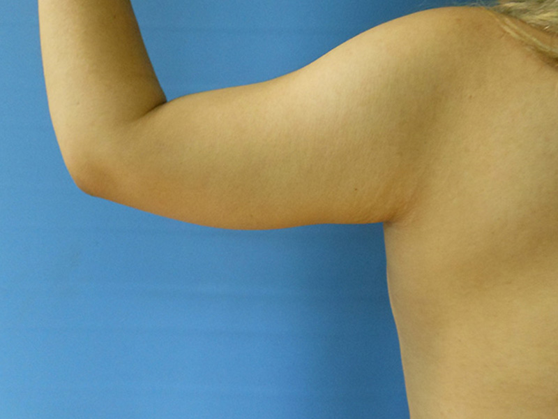 A close-up of a bare arm against a blue background