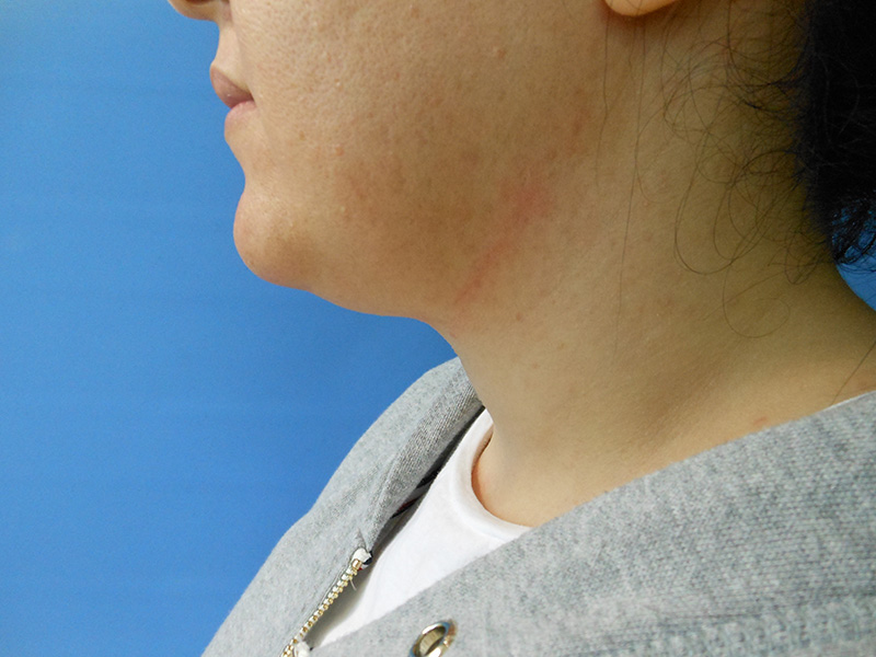 Profile view of a person with light skin and dark hair against a blue background