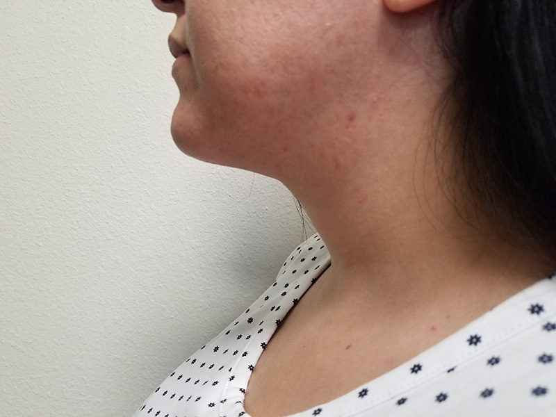 Side profile of a woman with dark hair, wearing a polka-dot shirt, against a plain background