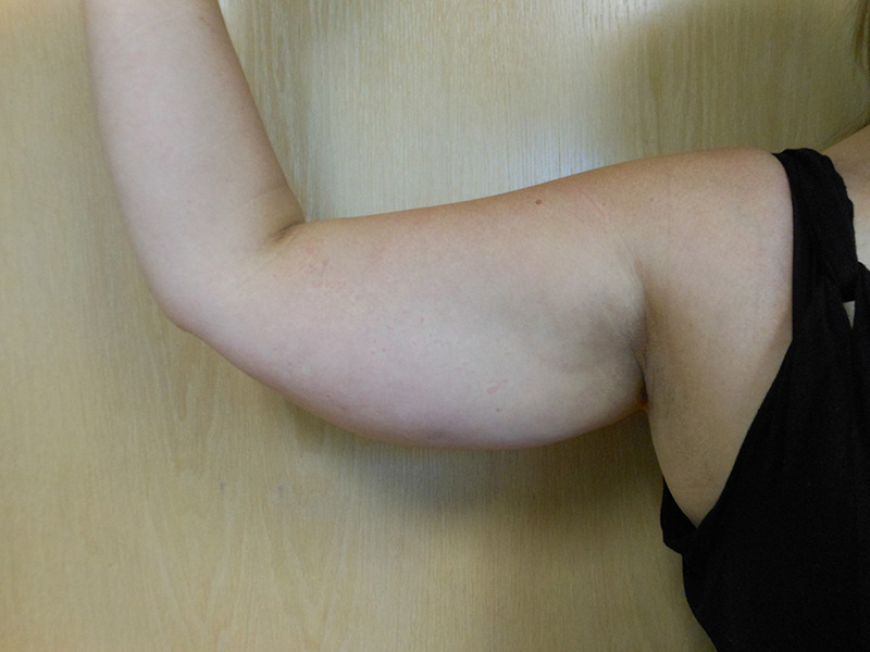 A close-up of a woman's upper arm against a wooden background
