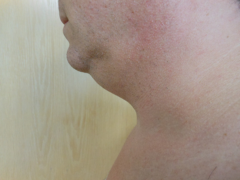 Profile view of a person's neck and chin against a light wooden background