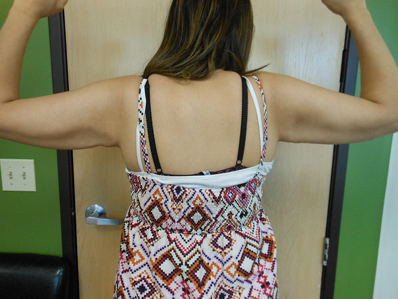 A person with long hair flexes arms, wearing a patterned top, viewed from the back