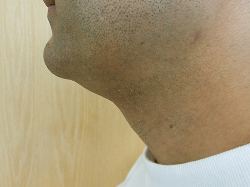 Side profile of a man's neck and jawline against a wooden background