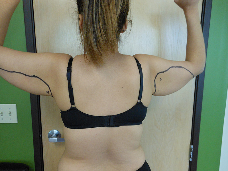 A woman standing with her back to the camera, flexing her arms