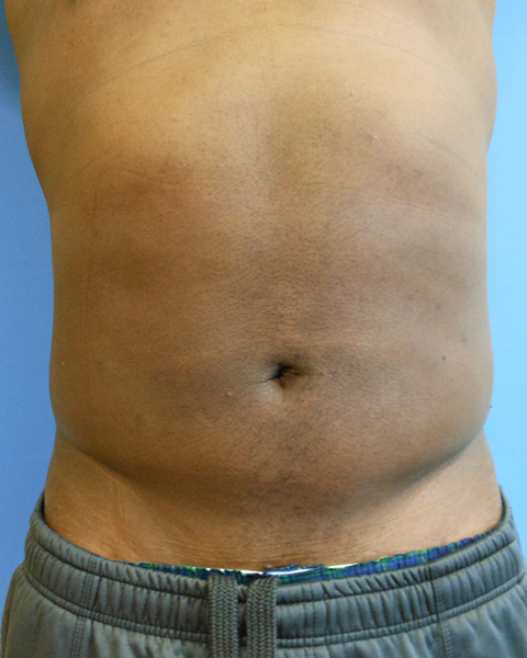 A bare torso of an individual with a visible navel against a blue background
