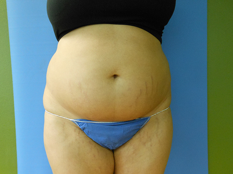 Close-up of a torso with a round belly, wearing a black top and blue underwear