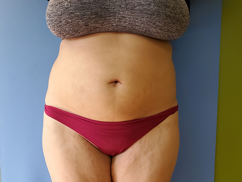 A person's midsection, wearing a brown top and maroon underwear, against a blue background
