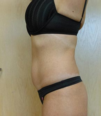 Side view of a person wearing a black bra and thong, displaying their stomach area