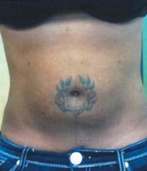 A close-up of a person's abdomen with a tattoo of a flower surrounded by leaves