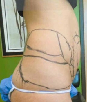 Side view of a person with a geometric tattoo on their hip
