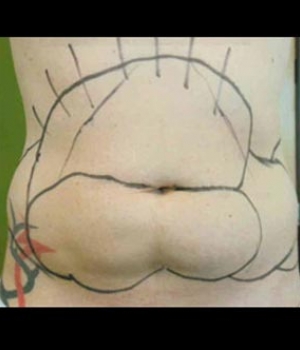 A bare back with a drawn outline resembling an animal's mouth