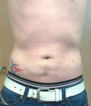 A bare torso showing a flat stomach and a tattoo on the left side