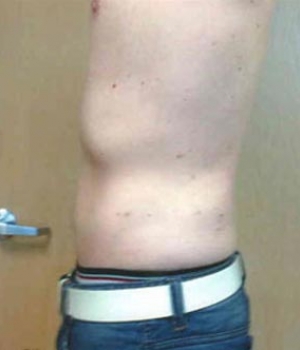 Side view of a person's torso, showing bare skin and a waistband