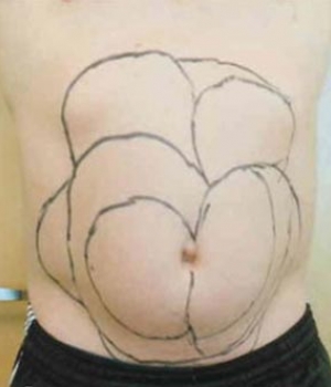 A bare chest with multiple large, curved lines drawn on it, resembling a flower shape