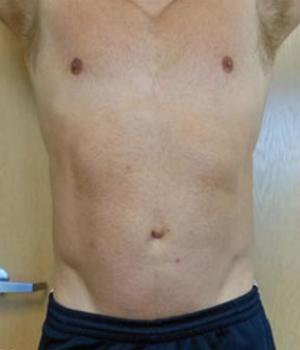 Close-up of a bare male torso showing the abdomen and chest