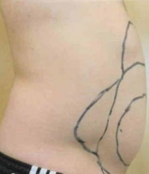 Side view of a torso with a prominent abstract tattoo on the side