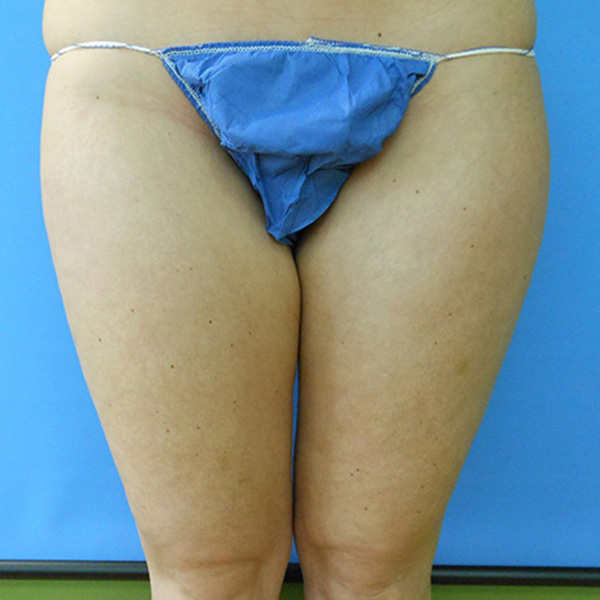 Image of a person wearing blue swimwear, standing with legs together against a blue background