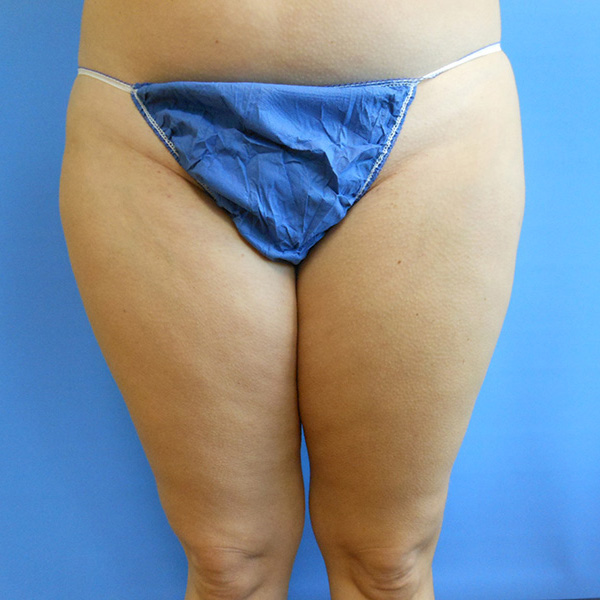 Person wearing a blue thong in front of a blue background
