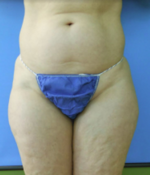 Woman's midsection, wearing a purple garment, against a blue background
