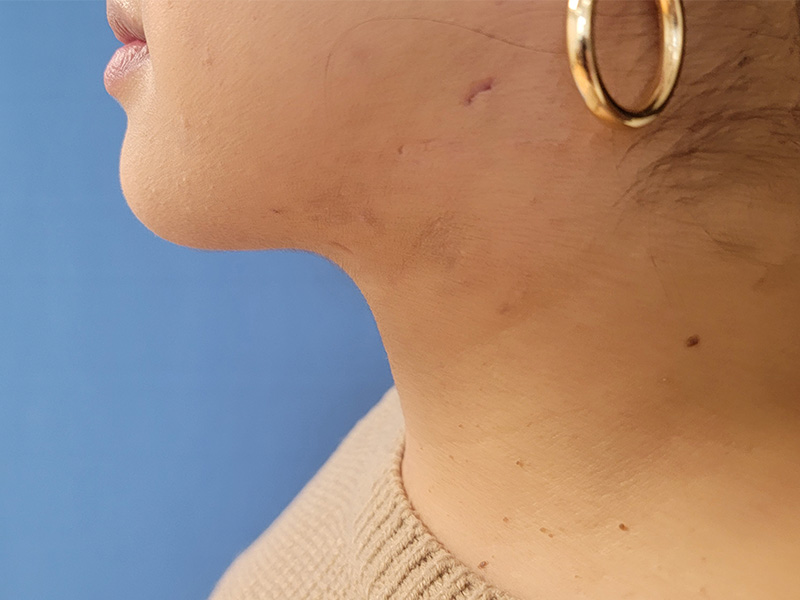 Profile of a person with hoop earrings, facing left against a blue background