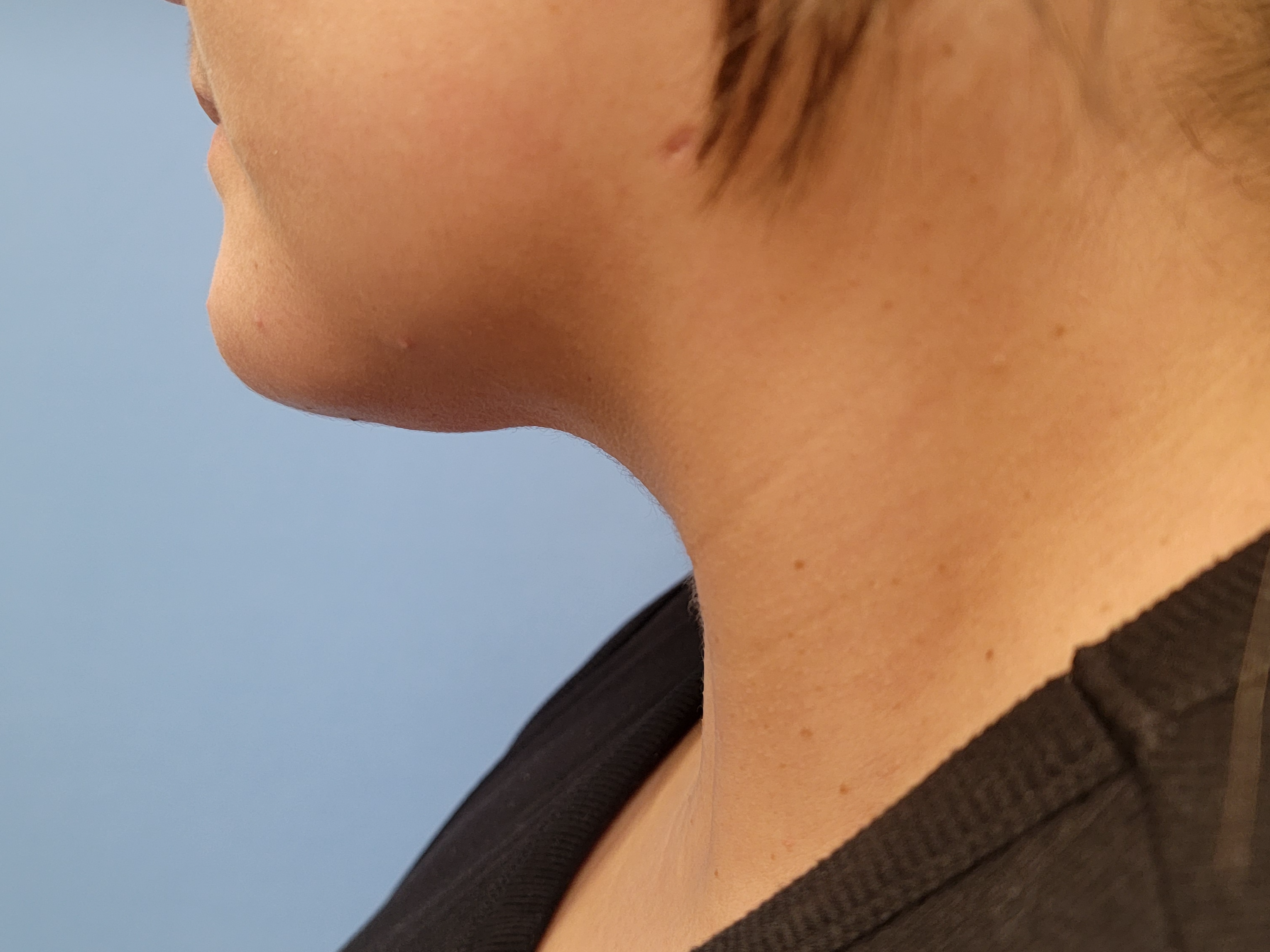 Profile view of a person's neck and jawline against a blue background